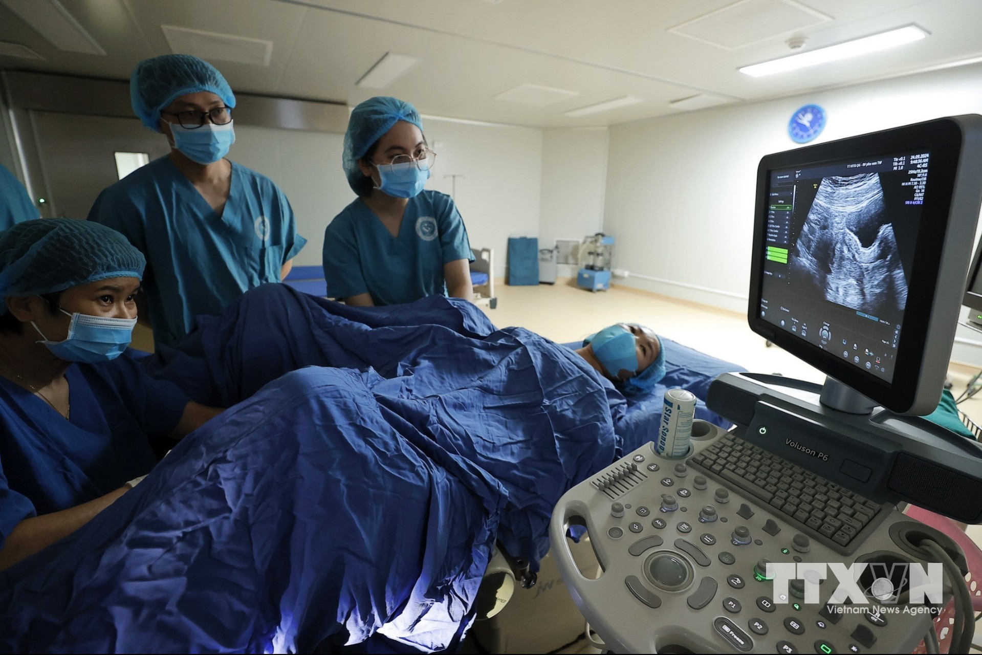 Có 2 kỹ thuật chuyển phôi, đó là chuyển phôi tươi và phôi đông lạnh. Nếu chuyển phôi tươi, người vợ được chuyển phôi ngay sau khi phôi tạo ra. Với phôi đông lạnh, toàn bộ số phôi đạt chất lượng sẽ được trữ đông, người vợ sẽ được chuyển phôi vào các chu kỳ tiếp theo. (Ảnh: Minh Quyết/TTXVN)